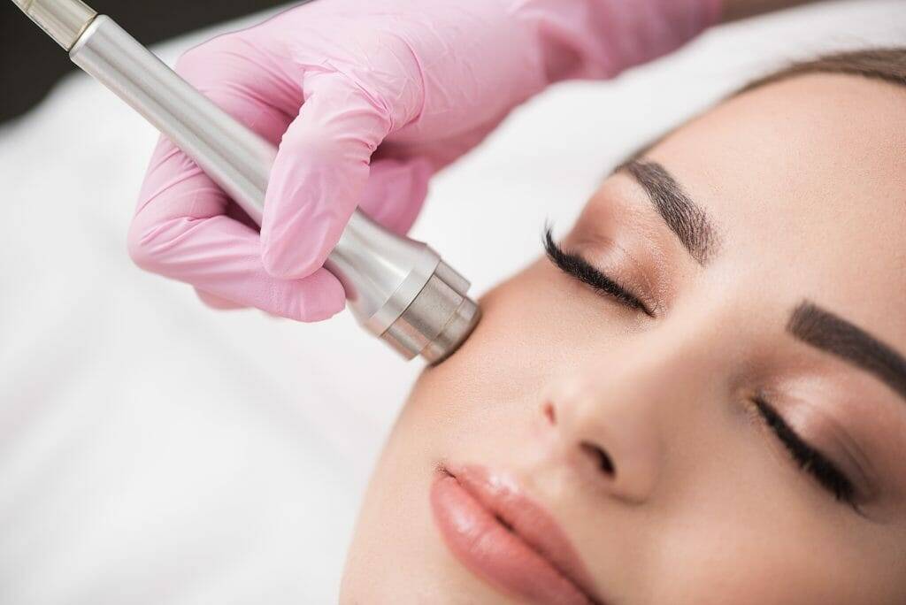 Mitesser entfernen 3 Diamant Microdermabrasion Wien