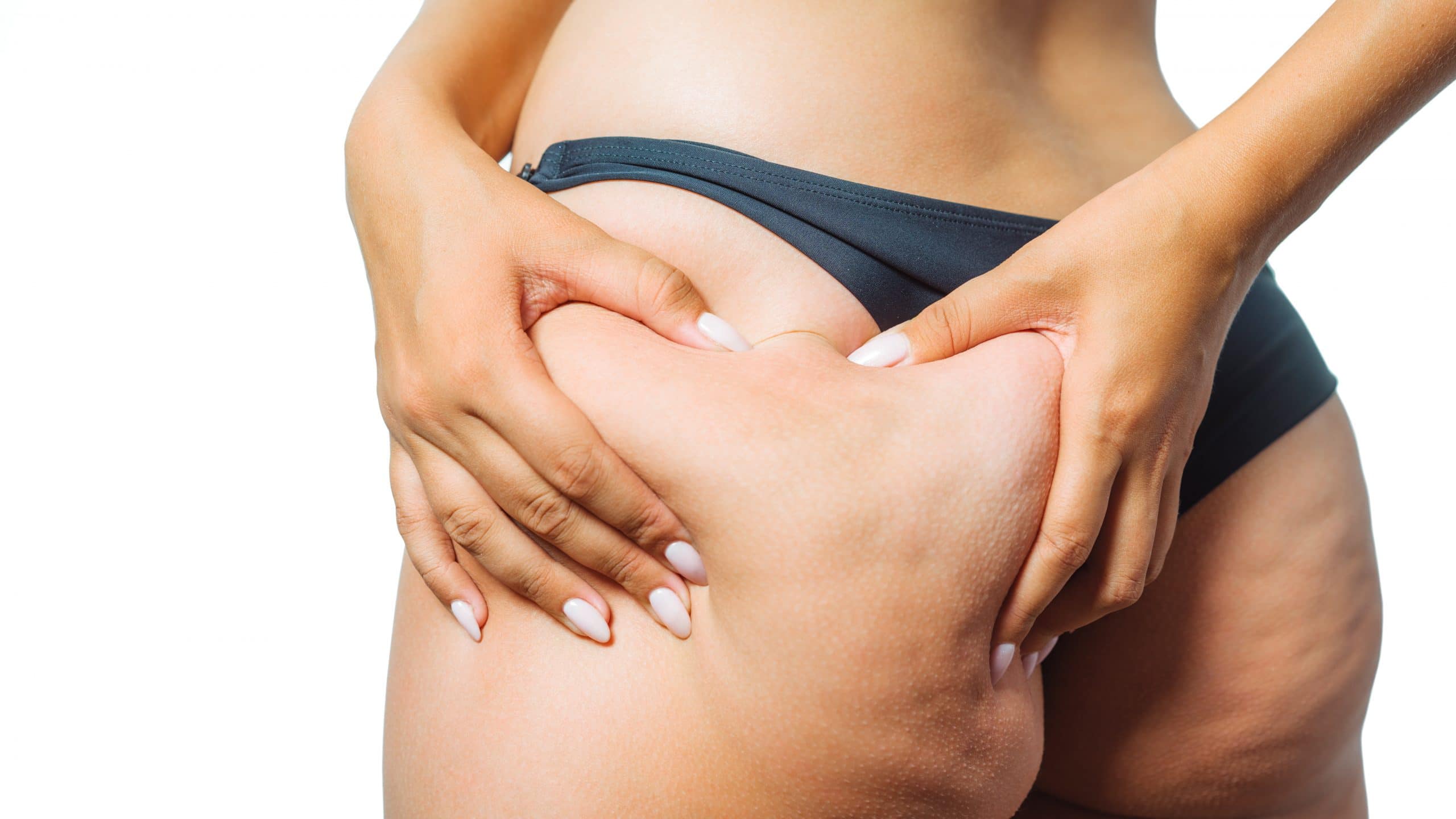 Cellulite Behandlungen Wien