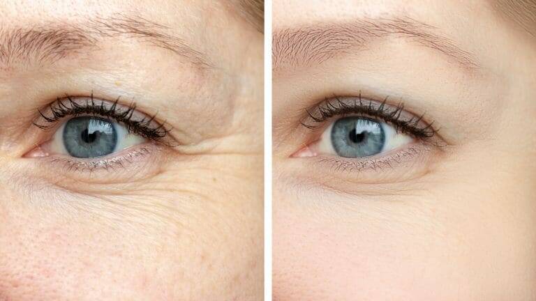 Anti Aging Behandlungen 4 Anti Aging Behandlung Wien