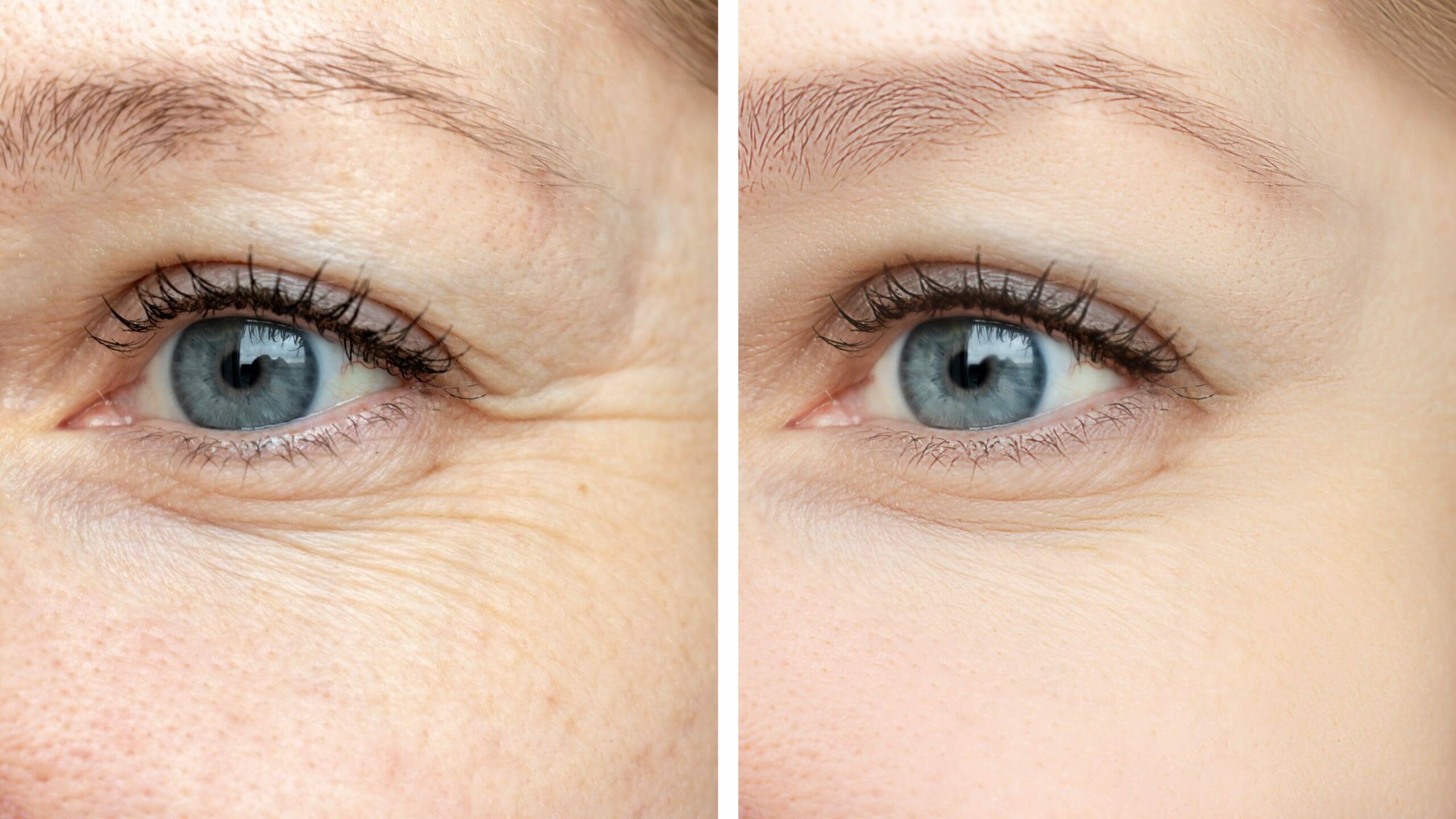 Anti Aging Behandlung Wien