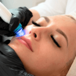 Aquacarbon Facial (Aquafacial + Carbon Laser)