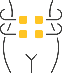 Kryolipolyse Wien 14 14 1
