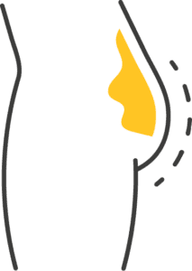 Kryolipolyse Wien 9 9 1
