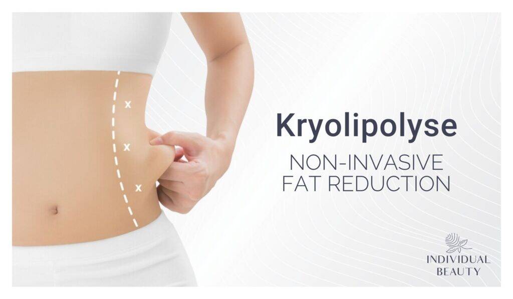 Kryolipolyse Wien 22 cryo non invasive