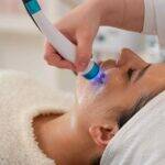 Augenfalten Behandlung mit Radiofrequenz (20 Min)