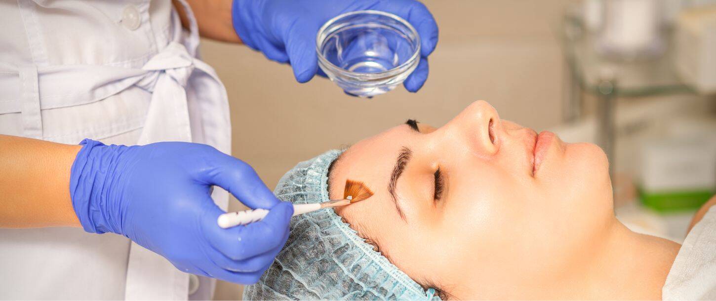 retinol peeling