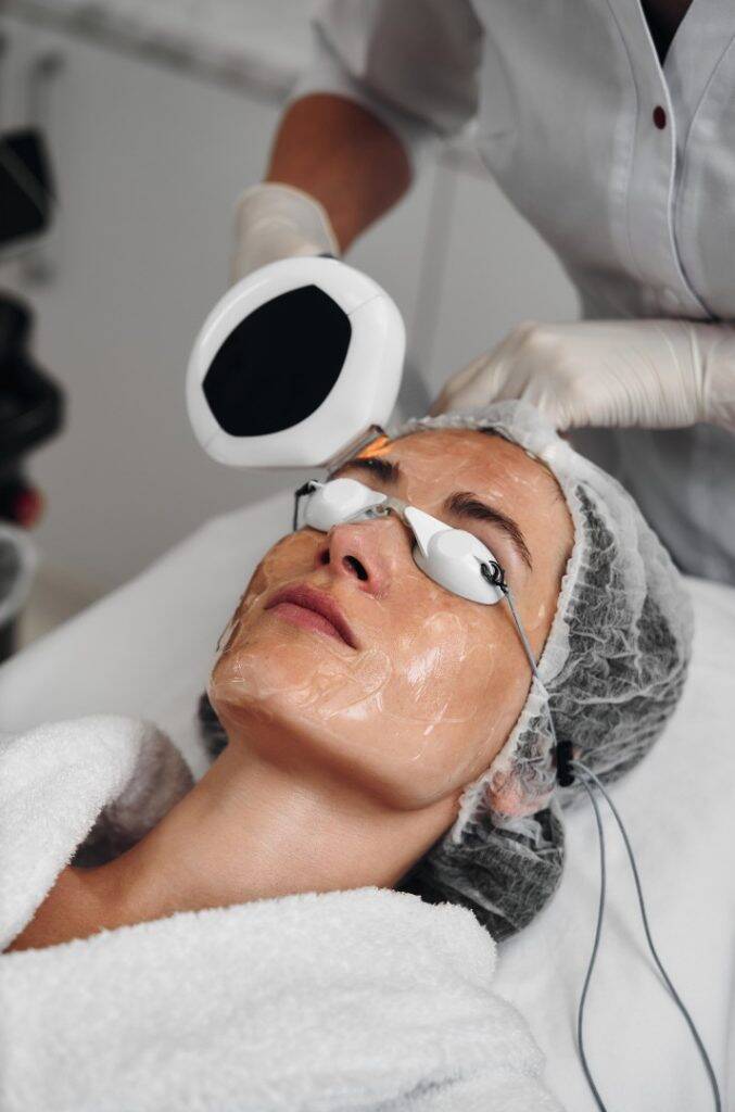 IPL Laser Wien – Laser-Gesichtsbehandlungen 2 IPL Laser wien