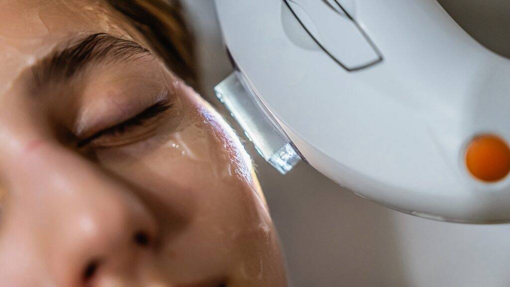 IPL Laser Wien – Laser-Gesichtsbehandlungen 3 ipl gesicht wien