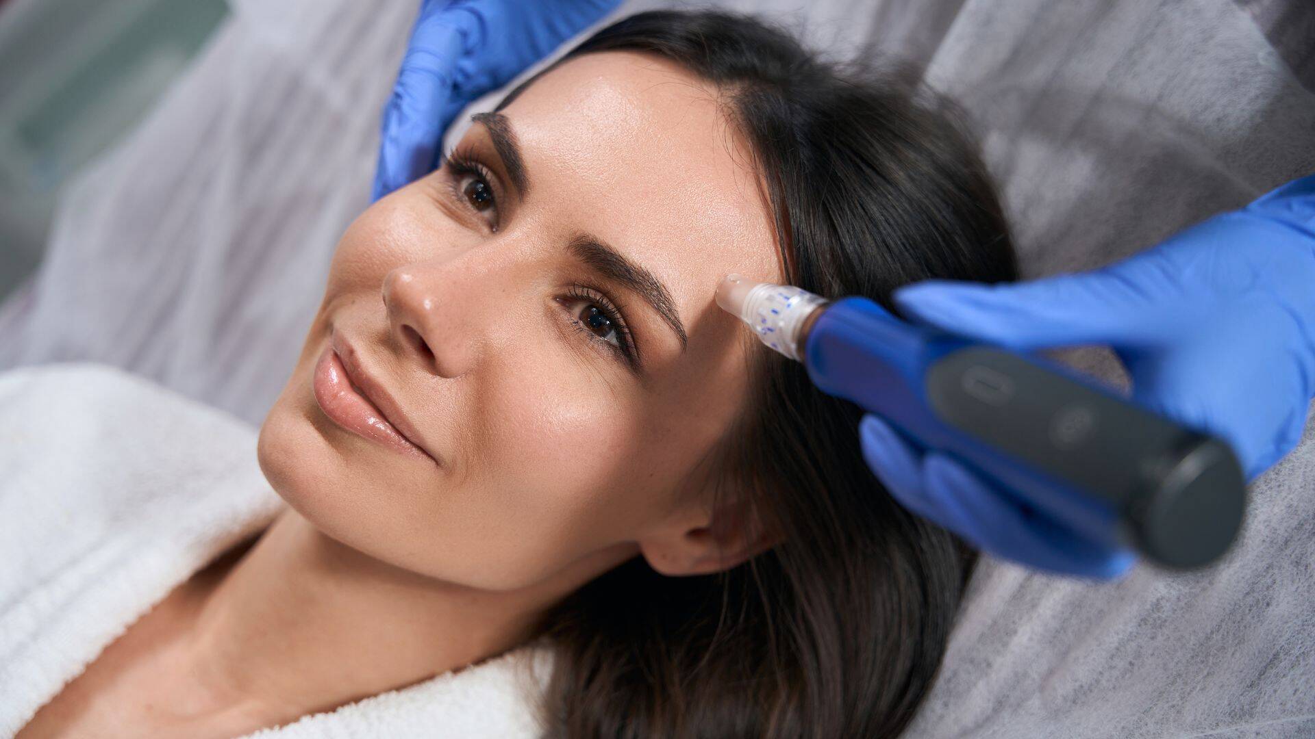 microneedling