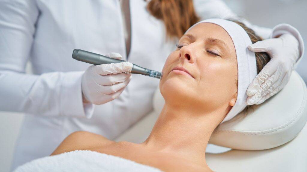 Die besten Microneedling vorher nachher Ergebnisse: Vor- und Nachteile im Überblick 1 microneedling 4