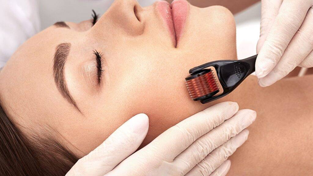 Die besten Microneedling vorher nachher Ergebnisse: Vor- und Nachteile im Überblick 5 microneedling dermaroller