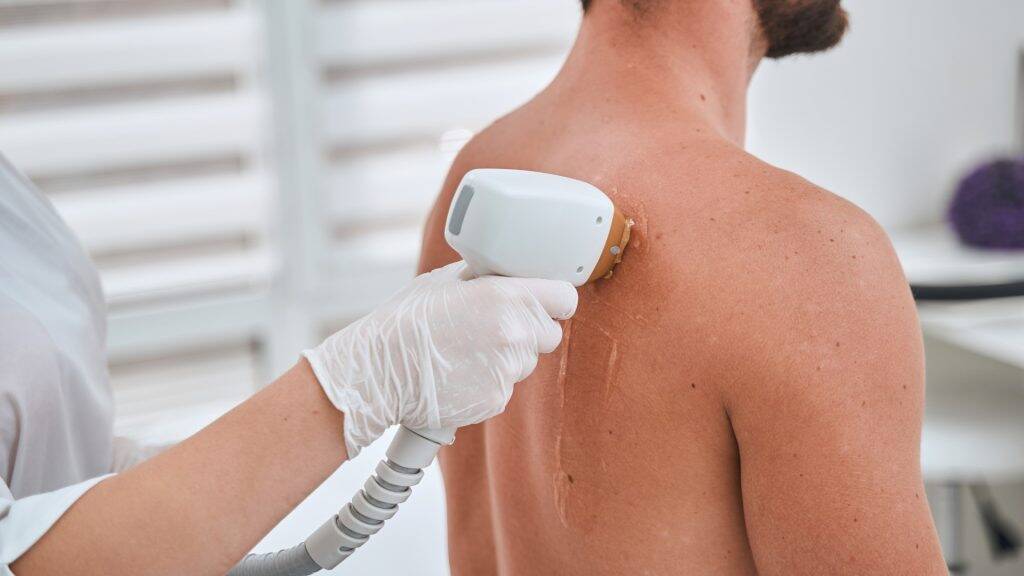Laser Haarentfernung im Test: Die besten Geräte für sicheres Ergebnis 2 LaserHair Removal 2
