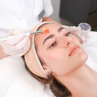 Couperose Behandlung Wien mit mesopeel MD azelan rx 1 chemische peeling amsterdam