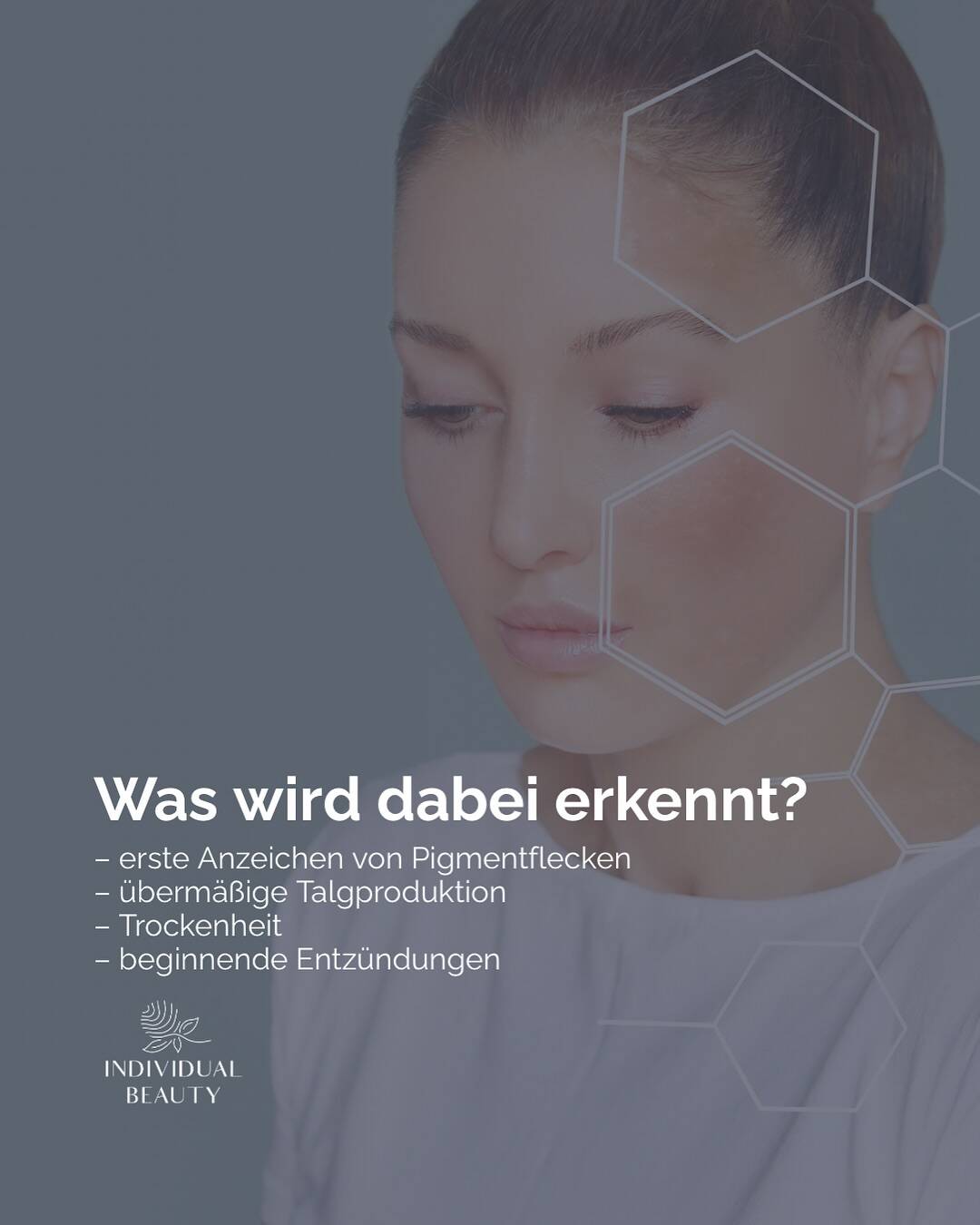 Weißt du, was unter deiner Haut wirklich passiert?
Nicht raten, nicht schätzen – wir zeigen es dir schwarz auf weiß.
Mit unserer professionellen Hautanalyse erkennst du in wenigen Minuten:
✨ Frühzeitige Pigmentveränderungen
✨ Überproduktion von Talg oder Trockenheit
✨ Entzündliche Prozesse
Alles sichtbar – objektiv, KI-gestützt und in höchster Bildqualität.
Und das Beste: Du bekommst keinen Produktberg, sondern einen klaren, individuellen Hautplan, der zu dir passt.
📍 Nur 49 € – und der Betrag wird bei deiner ersten Behandlung angerechnet.
Buche jetzt oder markiere deine Freundin, die endlich Klarheit will.
#individualbeautywien #hautpflegewien #kosmetikwien #hautdiagnose #hautscan #beautyvienna #skincarevienna #skinanalysis #wienbeauty #ästhetikwien #glowingskin #gesundehaut #viennaglow #hautberatung #beautyexpertinwien #selfcarewien #viennalife #skincareroutine #hautverstehen #smartskincare #hautanalysegerät