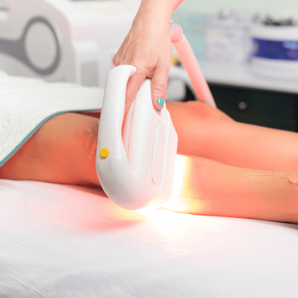 IPL Laser