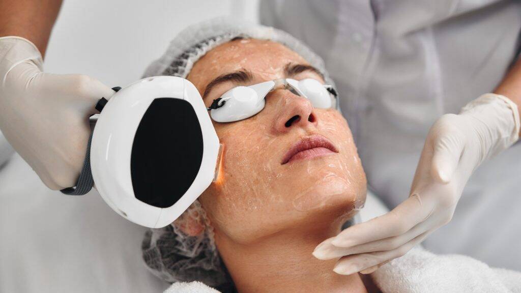 IPL Lasern 2