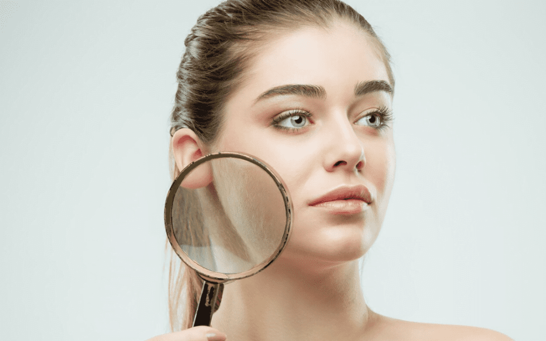 skin analysis