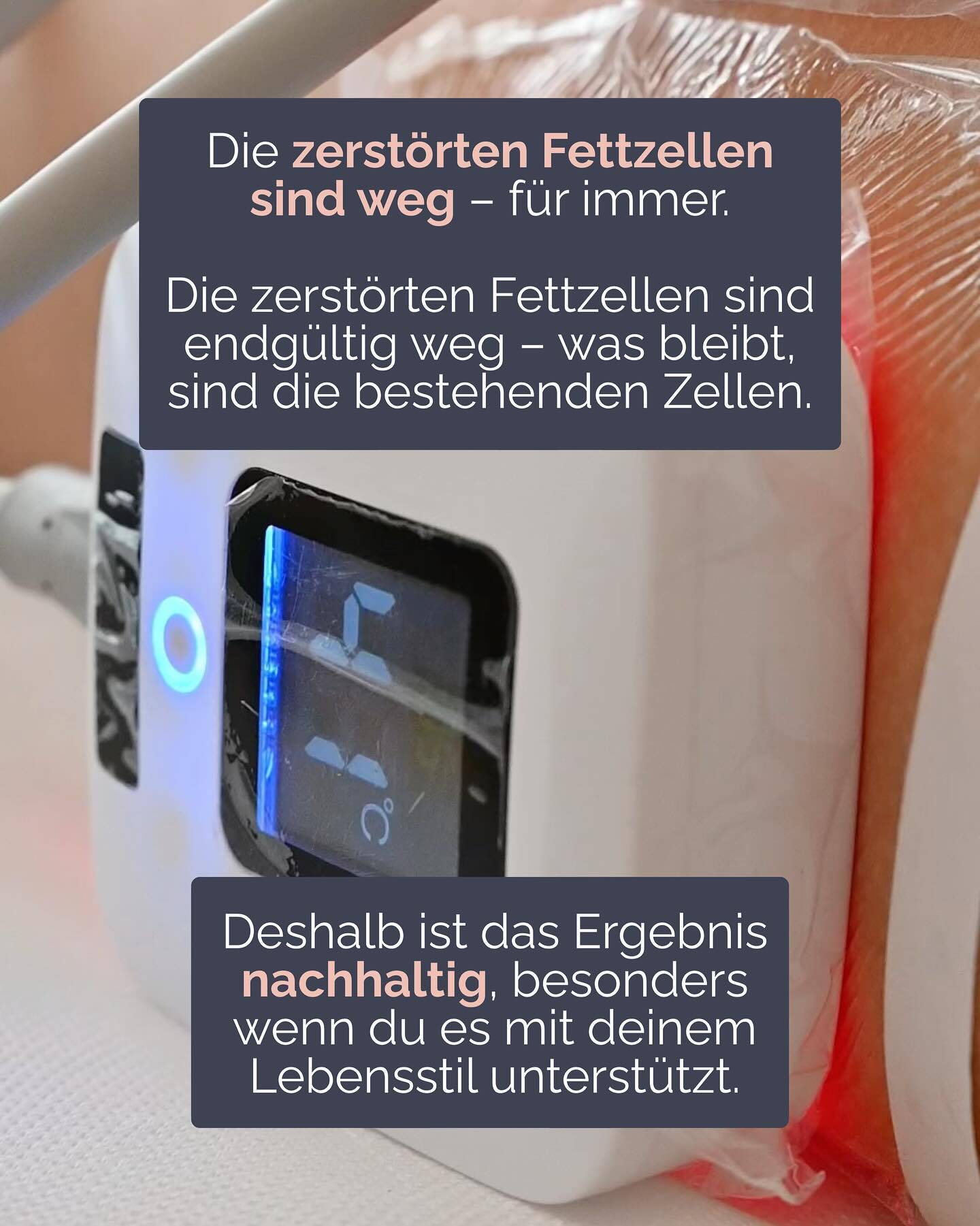 Viele glauben, Fettzellen würden durch Sport oder Diäten verschwinden. In Wirklichkeit verkleinern sie sich nur – sie bleiben aber im Körper.
Genau hier setzt MD Sculpt ID an:
Es zerstört Fettzellen gezielt und strafft gleichzeitig die Haut.
Das Ergebnis: weniger Fett, mehr Definition und spürbar straffere Haut – und das dauerhaft.
Und das Beste: in ganz Wien gibt’s MD Sculpt ID nur bei uns.
#wienbeauty #viennabeauty #mdsculptid #bodyforming #fettreduktion #hautstraffung #konturen #bodycontouring #figurformung #beautytreatment #wien #vienna #austria #igersvienna #wienliebe