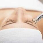 Diamant Microdermabrasion 