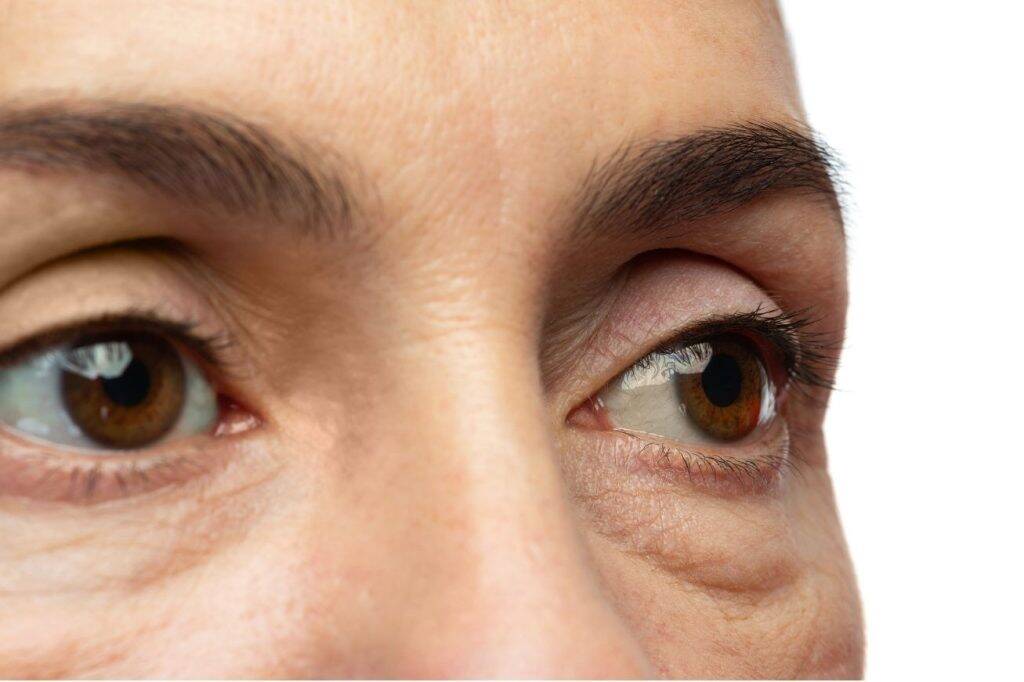 eyeabag