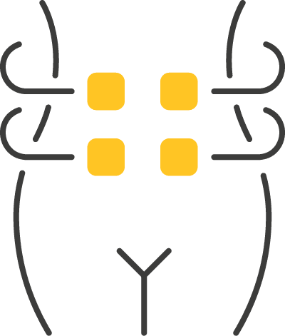 Kryolipolyse Wien 27 14 1