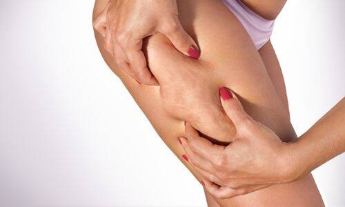 Cellulite Behandlung 15 cellulit cover 2