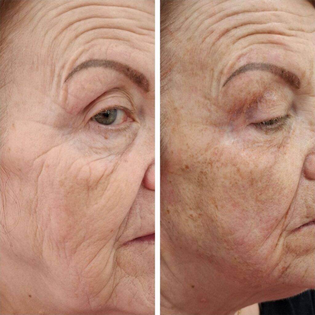 a woman's face with wrinkles
