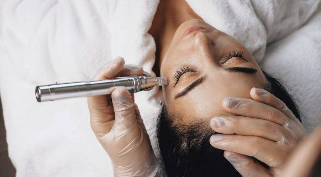 Microneedling - Preisliste