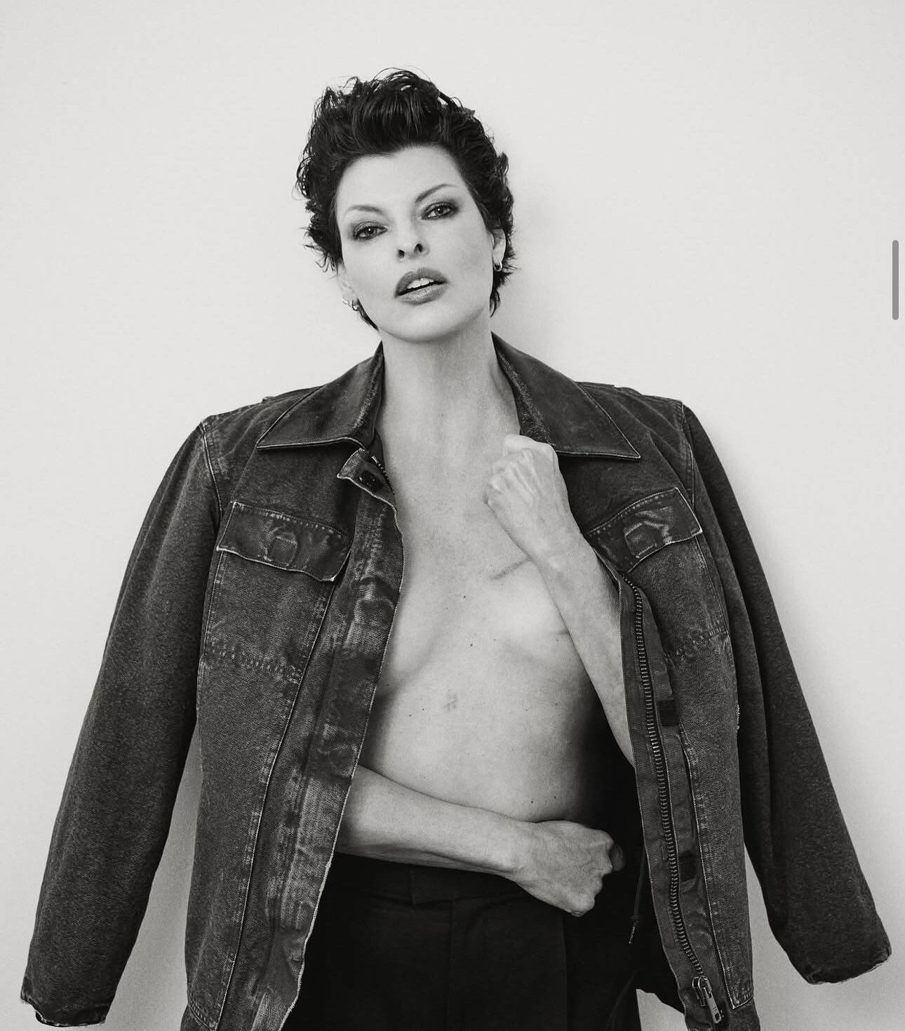 Coolsculpting Linda Evangelista