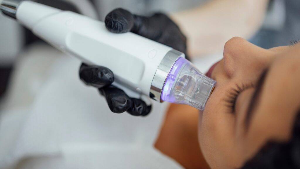 Radiofrequenz Microneedling