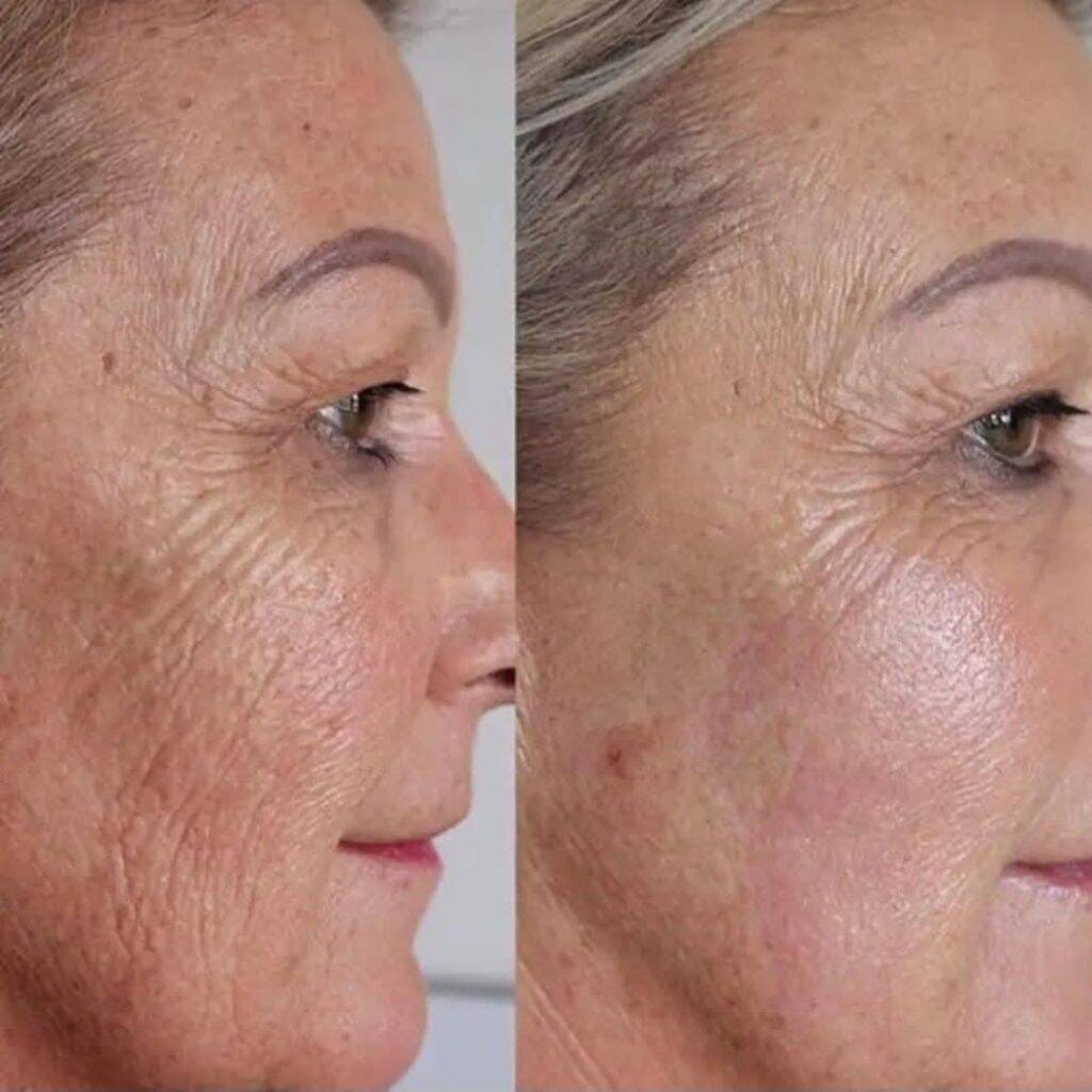 a woman's face with wrinkles