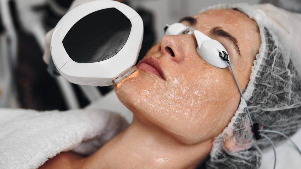 IPL Lasern 1