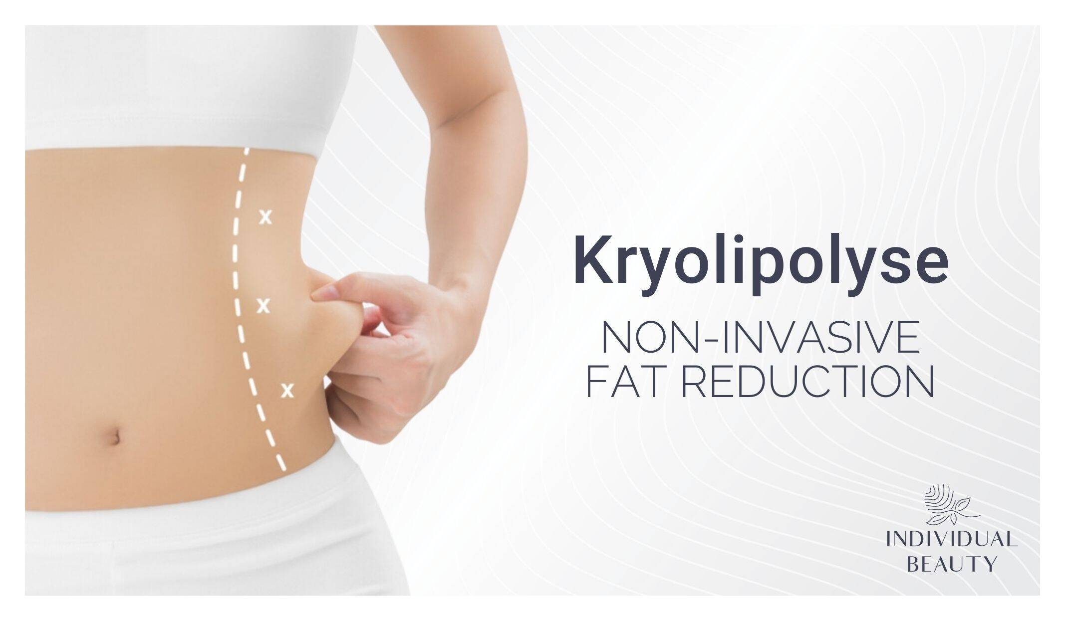 cryo non invasive