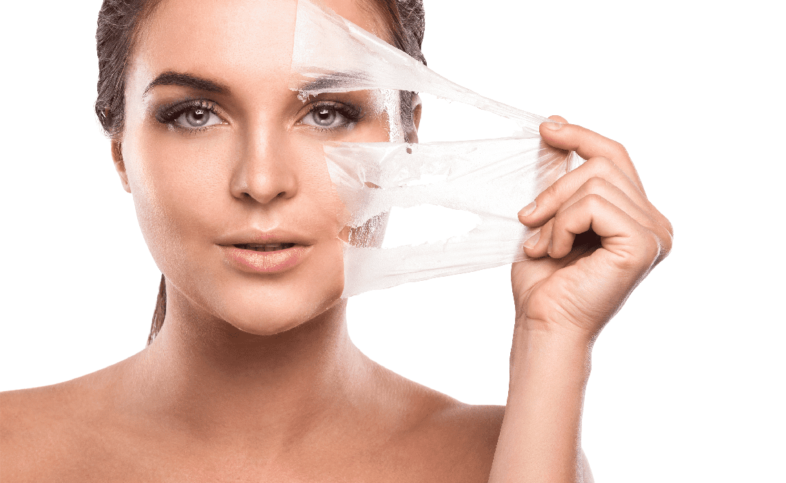 TCA Peeling Wien