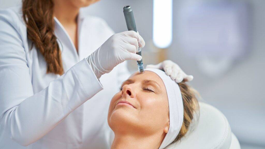 Microneedling wie oft? Alles, was Sie wissen müssen über die optimale Anwendung 1 microneedling