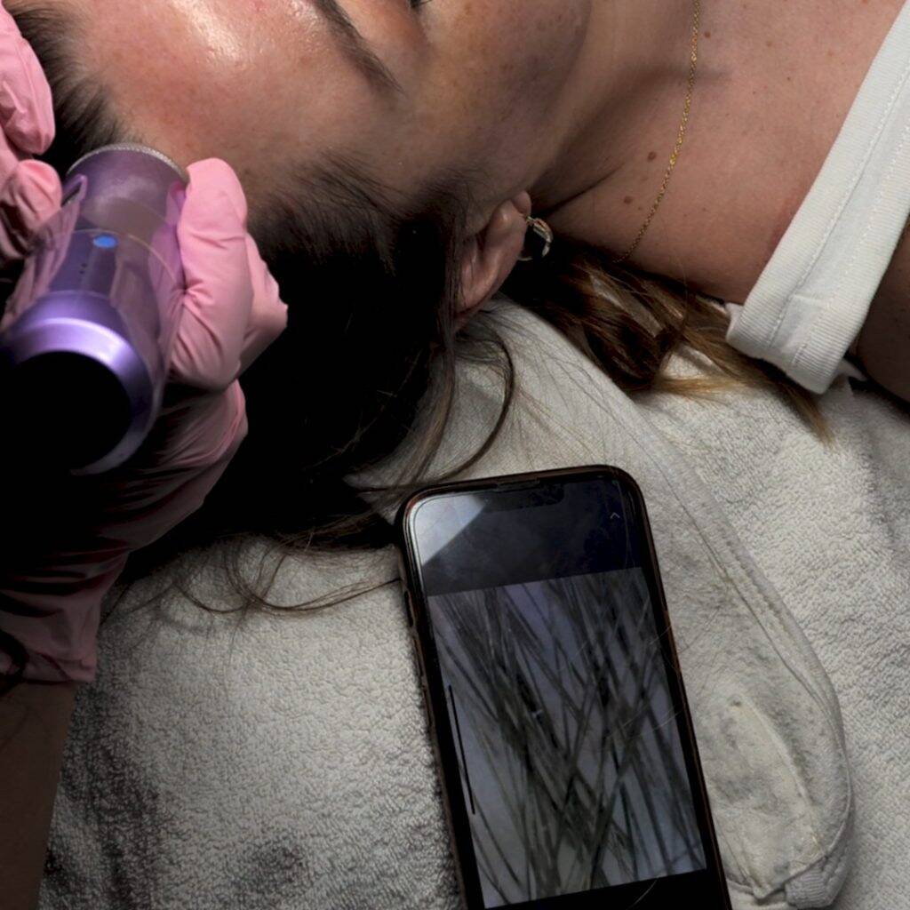skinanalyzer 2